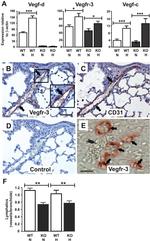 VEGF Receptor 3 Antibody in Immunohistochemistry (IHC)