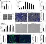 Myosin 4 Antibody in Western Blot (WB)