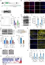 APP (Amyloid Precursor Protein) Antibody in Western Blot (WB)