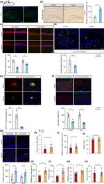 APP (Amyloid Precursor Protein) Antibody in Immunohistochemistry (IHC)