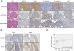 Snail1 Antibody in Immunocytochemistry, Immunohistochemistry (ICC/IF, IHC)