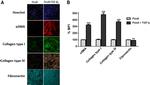 Collagen IV Antibody in Immunocytochemistry (ICC/IF)