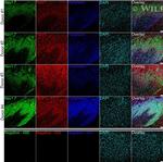 TRPV1 Antibody in Immunohistochemistry (IHC)