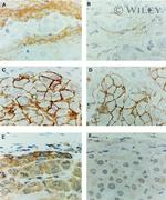 CD44var (v7-v8) Antibody in Immunohistochemistry (IHC)