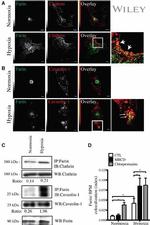 Furin Antibody in Immunoprecipitation (IP)