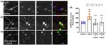 LAMP-2A Antibody in Immunocytochemistry (ICC/IF)