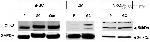 CLN3 Antibody in Western Blot (WB)