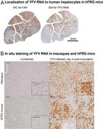 FAH Antibody in Immunohistochemistry (IHC)