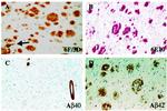 beta Amyloid (1-42) Antibody in Immunohistochemistry (IHC)