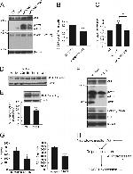 beta Amyloid Antibody in Western Blot (WB)