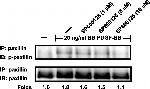 Phospho-Paxillin (Ser178) Antibody in Western Blot (WB)