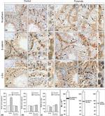 beta Catenin Antibody in Western Blot, Immunohistochemistry (Paraffin) (WB, IHC (P))