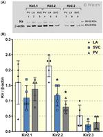 Kir2.1 (KCNJ2) Antibody in Western Blot (WB)