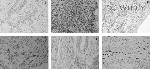 CD34 Antibody in Immunohistochemistry (IHC)