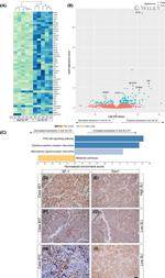 NR5A1 Antibody in Immunohistochemistry (IHC)