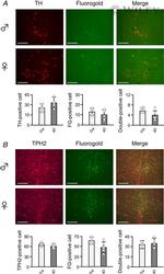 TPH2 Antibody in Immunohistochemistry (IHC)