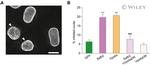 Lamin B2 Antibody in Immunocytochemistry (ICC/IF)