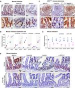 Phospho-BRCA1 (Ser1524) Antibody in Immunohistochemistry (IHC)