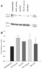 Connexin 26 Antibody in Western Blot (WB)