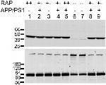 beta Amyloid Antibody in Western Blot (WB)