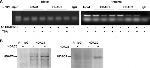 HDAC2 Antibody in Western Blot, Immunoprecipitation, ChIP Assay (WB, IP, ChIP)