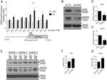 Estrogen Receptor beta Antibody in ChIP Assay (ChIP)