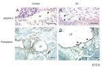 VEGF Receptor 3 Antibody in Immunohistochemistry (IHC)