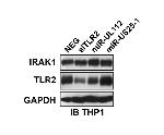 IRAK1 Antibody in Western Blot (WB)