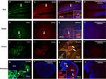 FOXL2 Antibody in Immunohistochemistry (IHC)