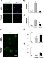 Connexin 36 Antibody in Immunocytochemistry (ICC/IF)