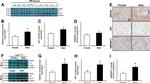 GPI Antibody in Western Blot, Immunohistochemistry (Paraffin) (WB, IHC (P))