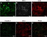 PMEL Antibody in Immunocytochemistry (ICC/IF)