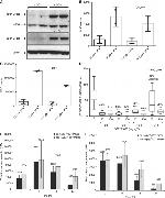 TTK Antibody in Western Blot (WB)