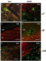 IBA1 Antibody in Immunohistochemistry (IHC)