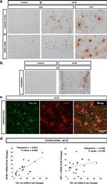 CHI3L1 Antibody in Immunohistochemistry (IHC)