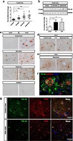 CHI3L1 Antibody in Immunohistochemistry (IHC)