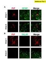 CHI3L1 Antibody in Immunohistochemistry (IHC)