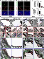 ZO-1 Antibody in Immunohistochemistry (IHC)