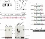 RASGRP1 Antibody in Western Blot (WB)