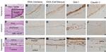 Claudin 1 Antibody in Immunohistochemistry (IHC)