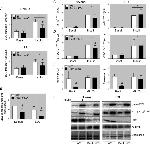 GLUT4 Antibody in Western Blot (WB)