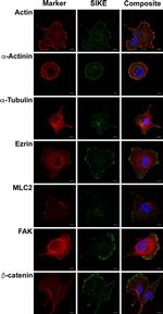 Ezrin Antibody in Immunocytochemistry (ICC/IF)