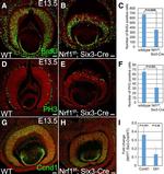 Cyclin D1 Antibody in Immunohistochemistry (IHC)