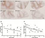 NEFL Antibody in Immunohistochemistry (IHC)