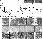 Cytokeratin 5 Antibody in Immunohistochemistry (Paraffin) (IHC (P))