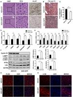 LC3B Antibody in Immunohistochemistry (IHC)