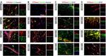 Complement C3 Antibody in Immunohistochemistry (IHC)