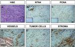 PCNA Antibody in Immunohistochemistry (IHC)