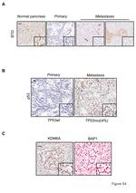 BTD Antibody in Immunohistochemistry (IHC)