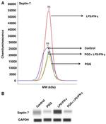 Septin-7 Antibody in Western Blot (WB)